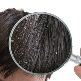 Noreva_Peau_Cheveux-pellicules_Signe1_540x540