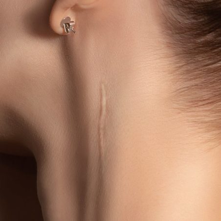 Noreva_Peau_Peau abimée_Header_1920 x 800