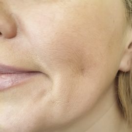 Noreva_Peau_Rides_Manquedefermete_540x540