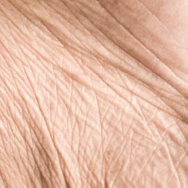 Noreva_Peau_Rides_Peauaffineeetridee_540x540