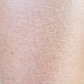 Noreva_Peau_Xerodiane-peau croco_Signe1_540x540